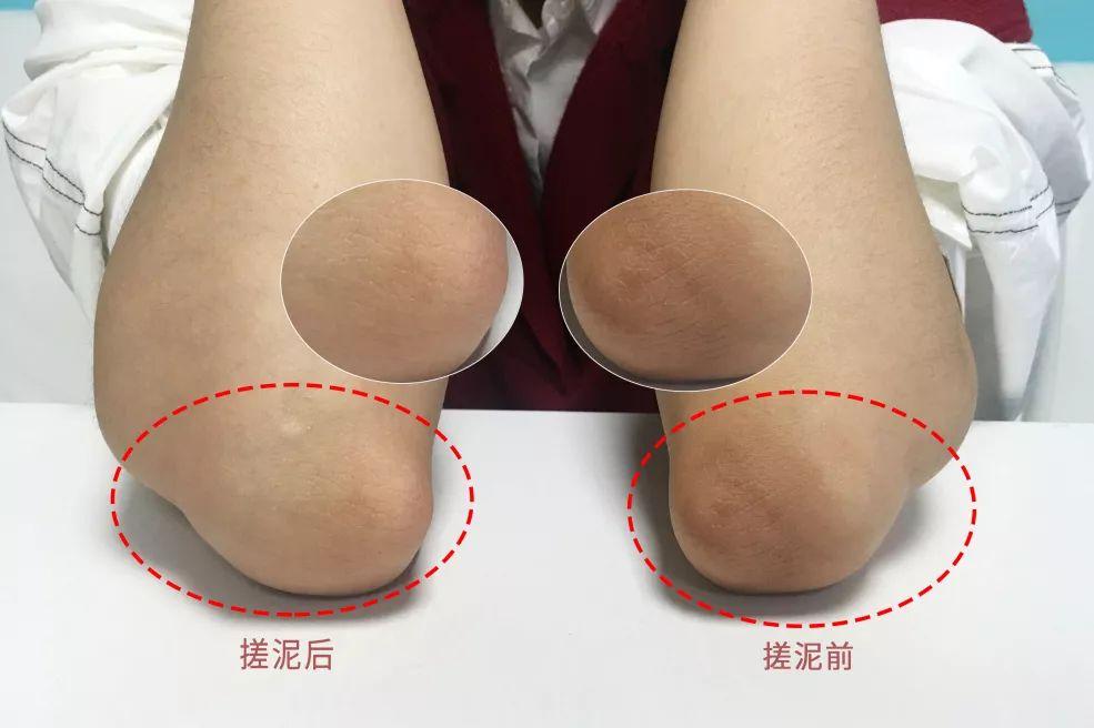 化工肥料 第219页